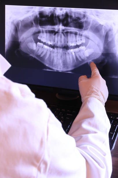 Best Walk-In Emergency Dentist in St Leon, IN